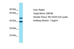 DBF4B Antibody, Novus Biologicals 100 &mu;L; Unconjugated:Antibodies, Polyclonal